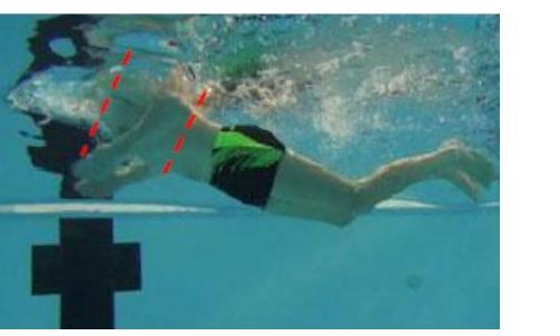 Coudes trop en arrière