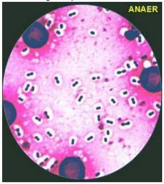 Méningocoque encapsulé