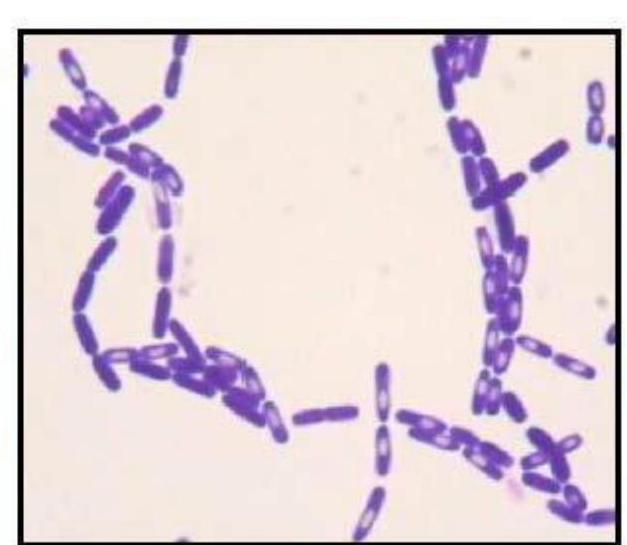 Spores en coloration de Gram